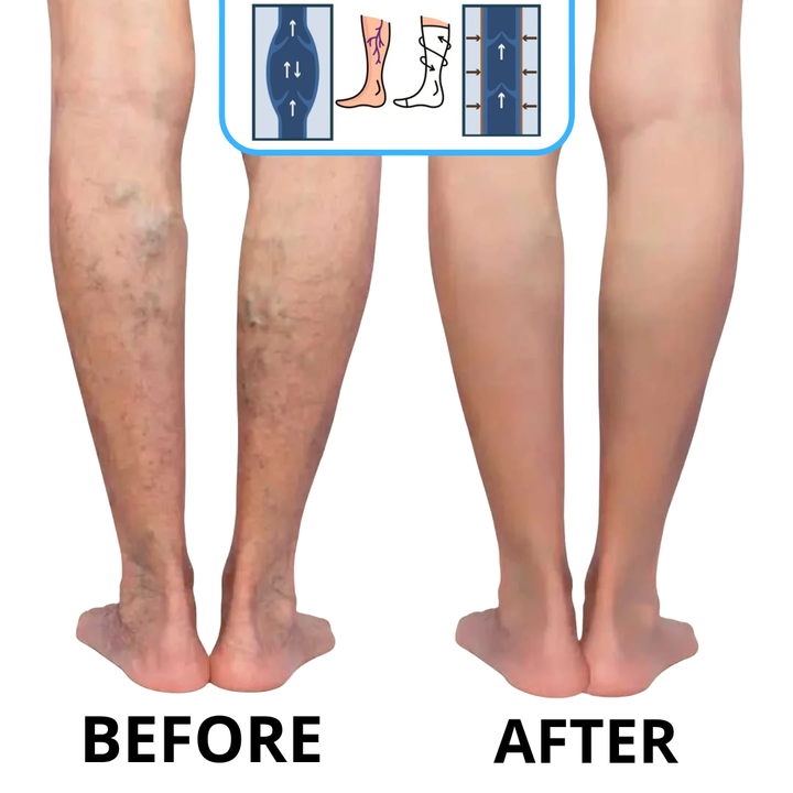 SURESTEP™ SOCKS | COMPRESSION SOCKS